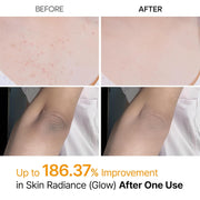 Peel Shot Kojic Acid + Turmeric Spray