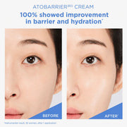 Atobarrier365 Cream